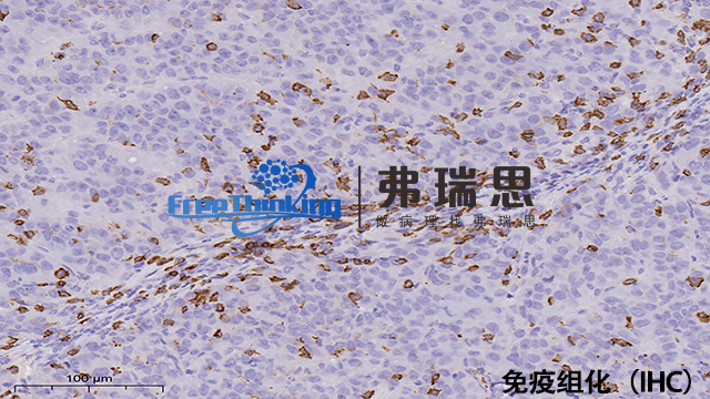 连云港病理切片免疫组化扫描 南京弗瑞思生物科技供应