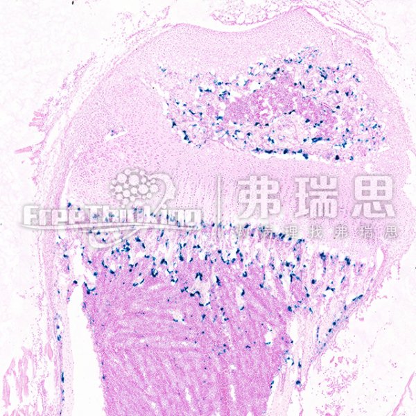 β-半乳糖苷酶染色