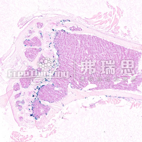 β-半乳糖苷酶染色