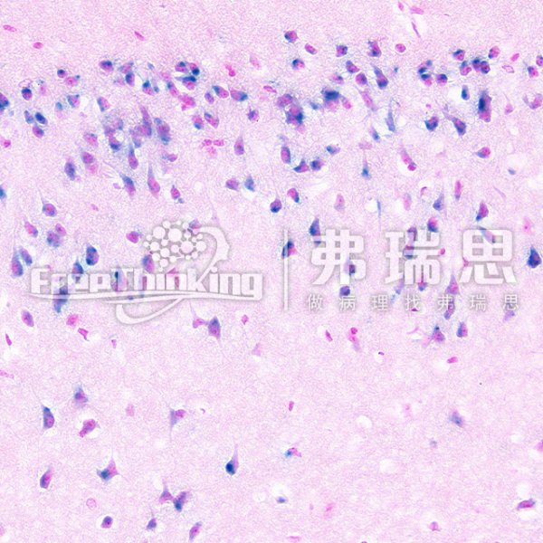 β-半乳糖苷酶染色