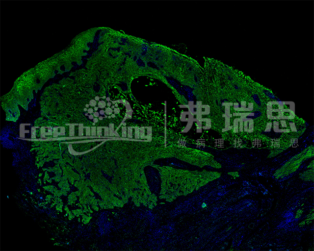 病理實驗前處理的關鍵是哪個環(huán)節(jié)，你知道么？？？