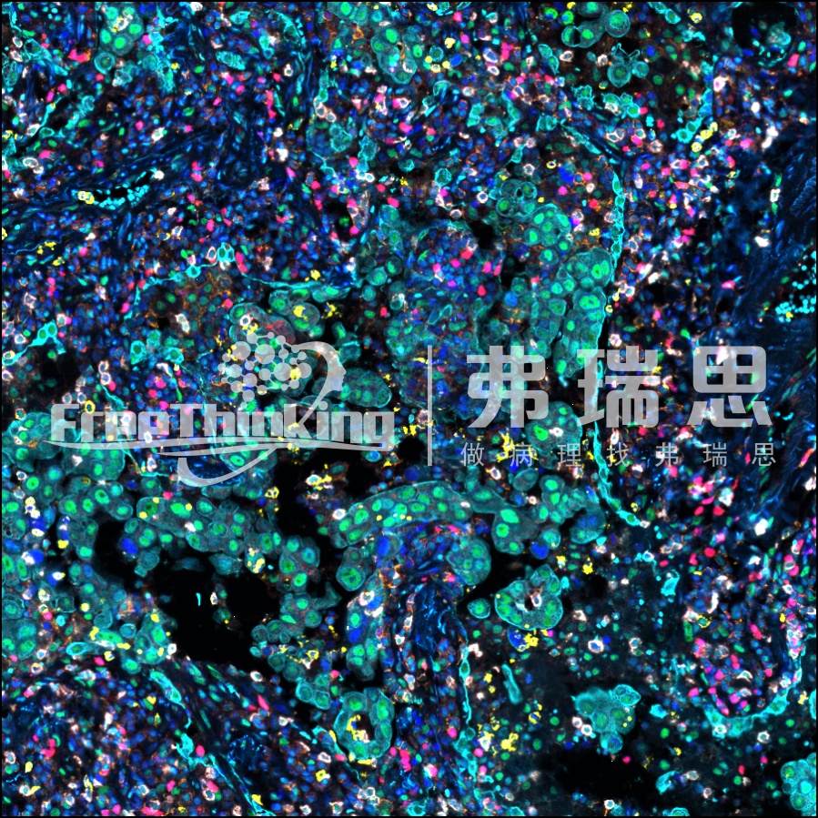 知識小亮點|冰凍切片預防冰晶的方法及注意事項