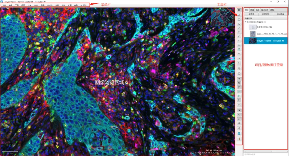 科研福音，病理圖像分析軟件TerrydrViewer 重磅上線?。。? title=