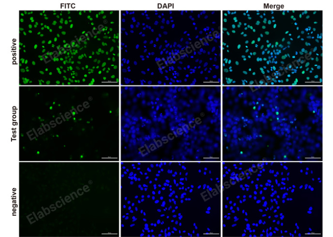 游离脂肪酸(NEFA/FFA) 比色法测试盒Elabscience生产 长石生物上海供应