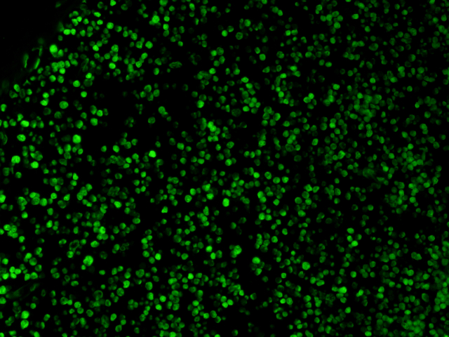 二肽基肽酶4(DPP4)抑制劑篩選測試盒Elabscience定制,Elabscience