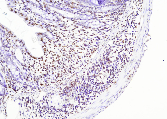 游离脂肪酸(NEFA/FFA) 比色法测试盒Elabscience生产,Elabscience