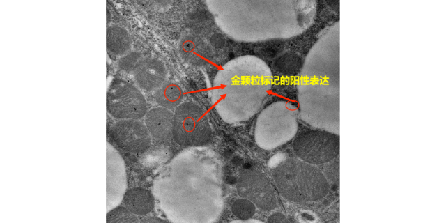 广州免疫电镜技术用途