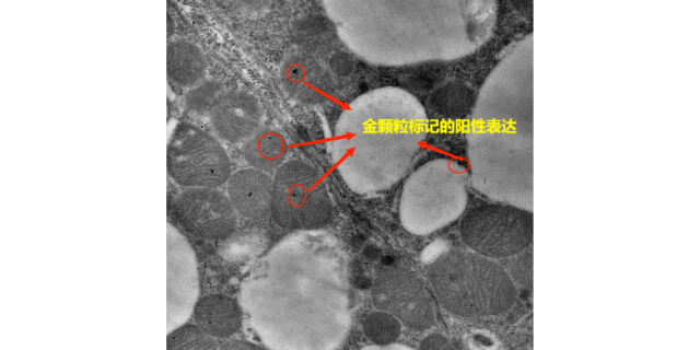 无锡亚细胞水平免疫电镜技术哪家专业