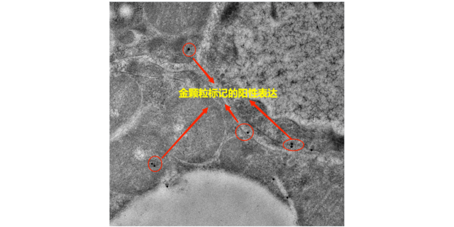 上海高靈敏度免疫電鏡技術(shù)方案 服務(wù)為先 上海司鼎生物科技供應(yīng)