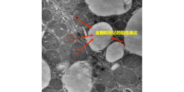 漳州病毒免疫电镜检测服务