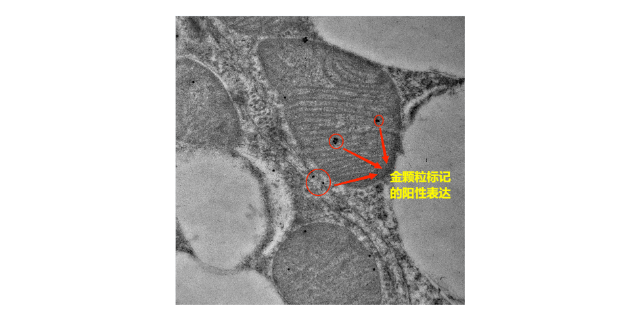 黄石发病机理免疫电镜技术特点