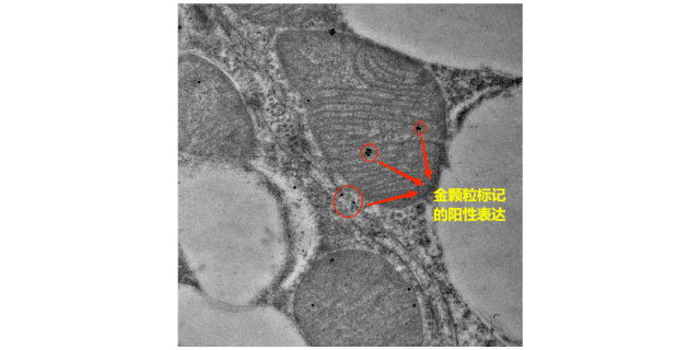 无锡亚细胞水平免疫电镜检测哪家专业