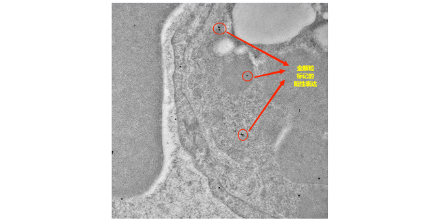 黄石发病机理免疫电镜检测服务