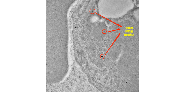 武汉高精确度免疫电镜检测应用