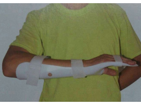 南京假肢矫形器厂家 欢迎来电 无锡精博康复供应