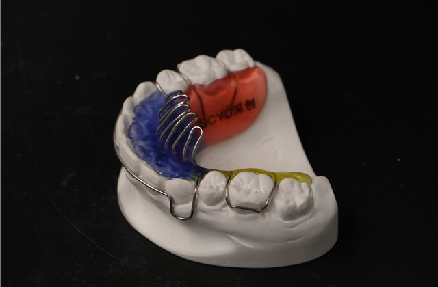 江西弹簧推牙矫正器定制价格 深圳市深创义齿技术供应