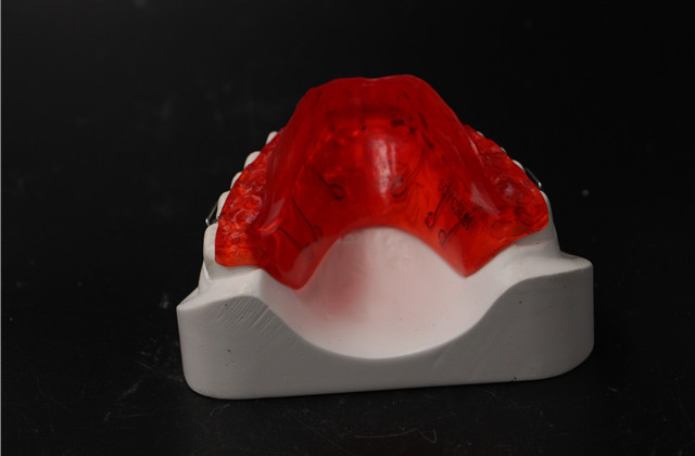 湖南弹簧推牙矫正器公司 深圳市深创义齿技术供应