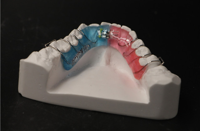 江西儿童牙齿矫正器参考价 深圳市深创义齿技术供应