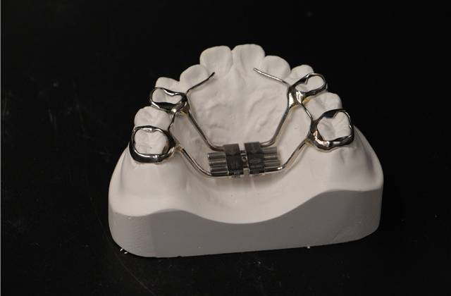 儿童牙齿矫正器 深圳市深创义齿技术供应