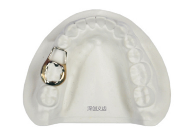 深圳牙齿间隙保持器怎么样 深圳市深创义齿技术供应