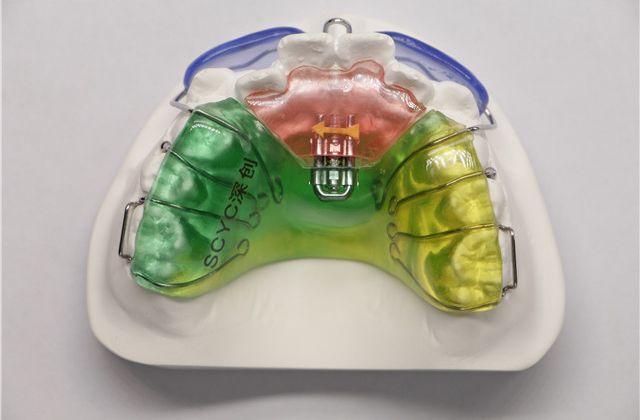 深圳儿童牙齿矫正器要戴多久 深圳市深创义齿技术供应