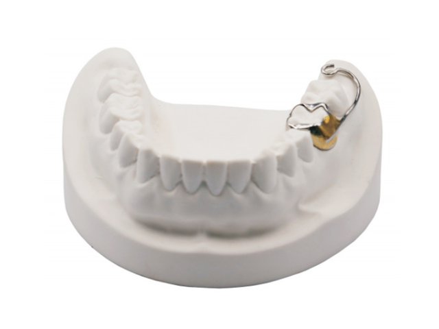 重庆磨牙压低器咨询电话 深圳市深创义齿技术供应