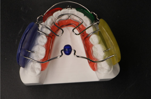 江西弹簧推牙矫正器怎么样 深圳市深创义齿技术供应