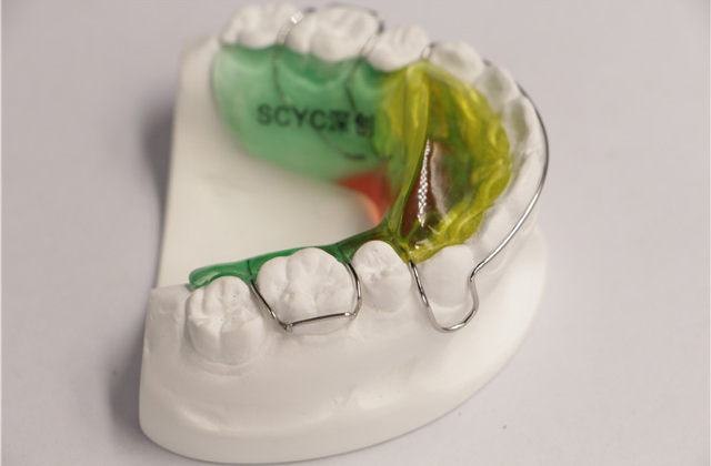 深圳儿童牙齿矫正器要戴多久 深圳市深创义齿技术供应