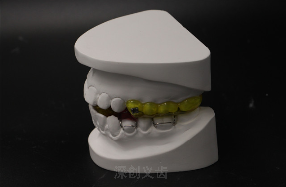 四川上颌反颌矫正器参考价 深圳市深创义齿技术供应