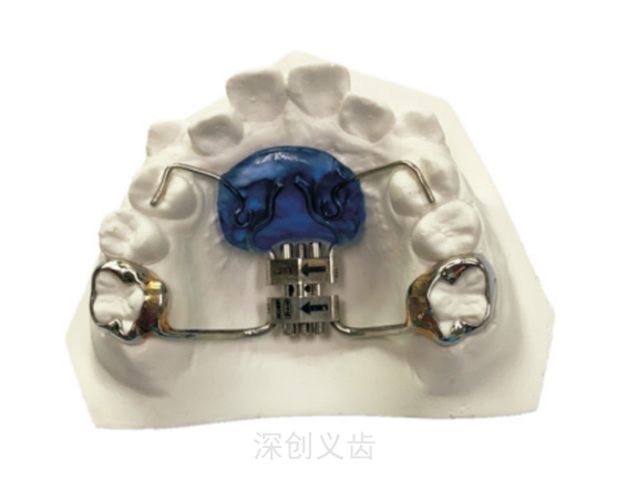 舌侧磨牙压低器如何佩戴 深圳市深创义齿技术供应