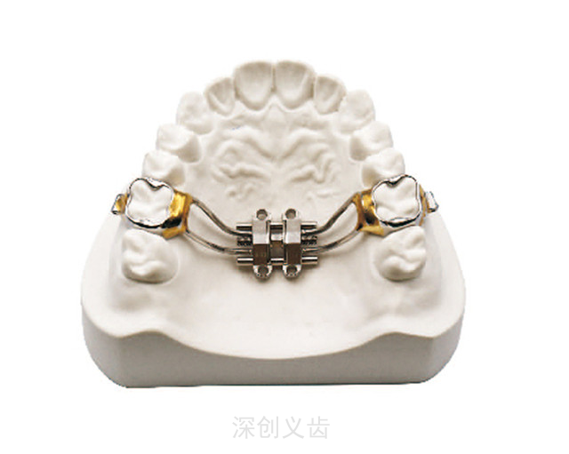福建隐形牙套扩弓器如何佩戴 深圳市深创义齿技术供应
