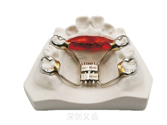 深圳下颌磨牙推进器公司 深圳市深创义齿技术供应