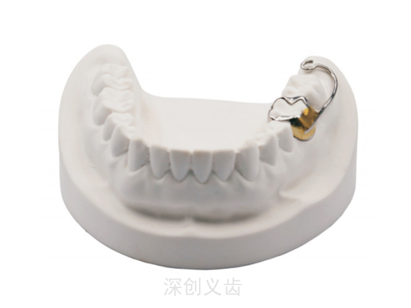 甘肃下颌磨牙推进器 深圳市深创义齿技术供应