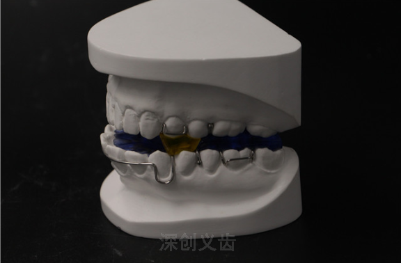 广西上颌反颌矫正器定制 深圳市深创义齿技术供应