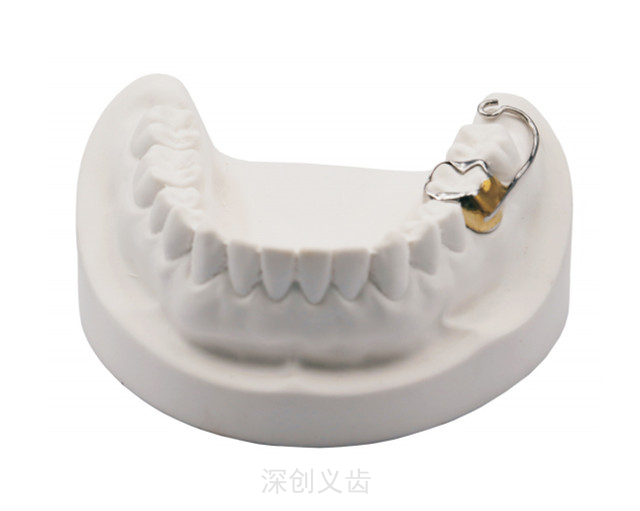 海南口外弓磨牙压低器如何佩戴 深圳市深创义齿技术供应
