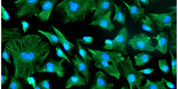 上海疾病模型原代細(xì)胞實(shí)驗(yàn) 動(dòng)物模型 上海研錄生物醫(yī)藥供應(yīng)