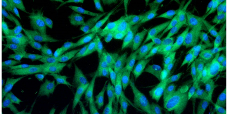 上海裸鼠原代細(xì)胞技術(shù) 動(dòng)物模型 上海研錄生物醫(yī)藥供應(yīng)