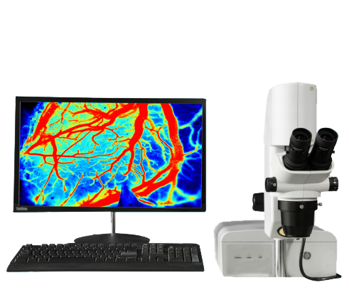 激光散斑血流儀