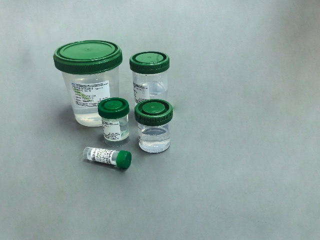 天津甲醛組織固定液定制 南京鼎泰醫(yī)療用品供應(yīng);