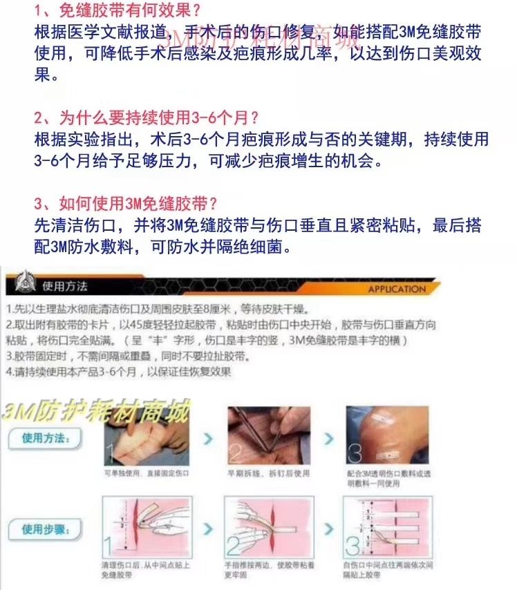 皮膚傷口膠帶