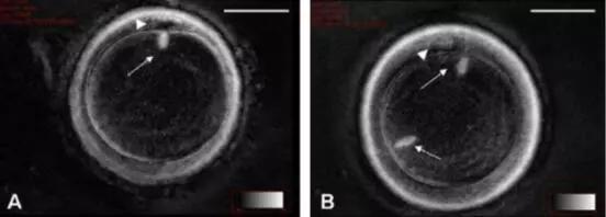 上海双折射性纺锤体卵细胞评价 上海嵩皓科学仪器供应