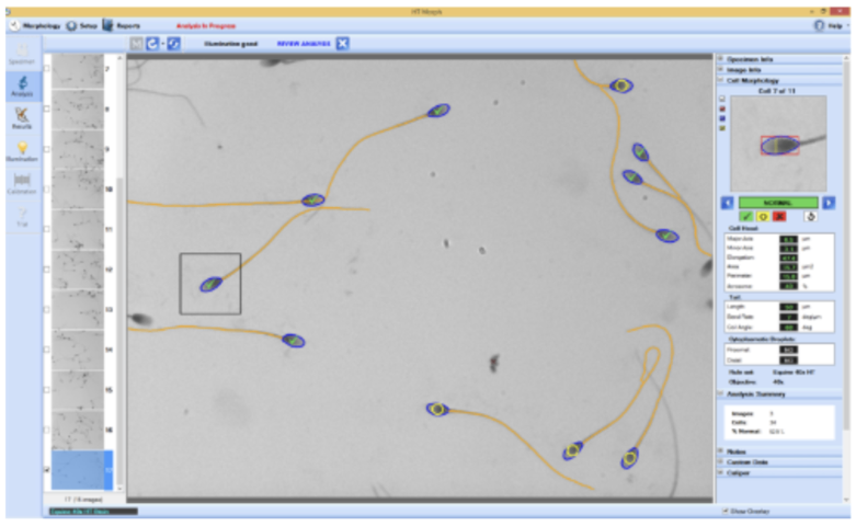 馬精子分析VCL,精子分析