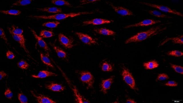 肺動脈成纖維細胞細胞詢問報價 無錫菩禾生物醫藥技術供應