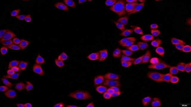 胰腺导管上皮细胞细胞技术指导 无锡菩禾生物医药技术供应