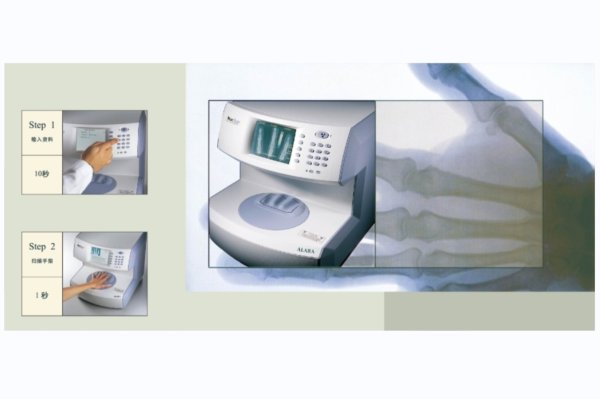 Miles Medical LLC邁爾思 X射線骨密度儀MetriScan 測(cè)手指