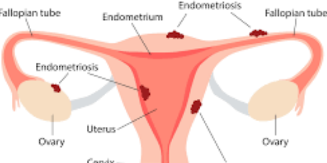 江蘇子宮內(nèi)膜異位癥模型哪家口碑好 服務(wù)為先 南京英瀚斯生物科技供應(yīng)