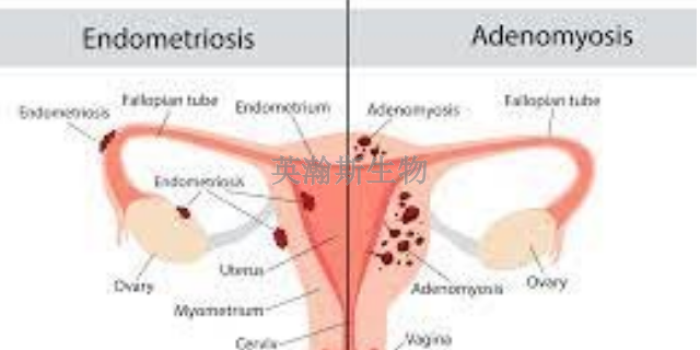 湖南小鼠子宫内膜异位症模型实验外包