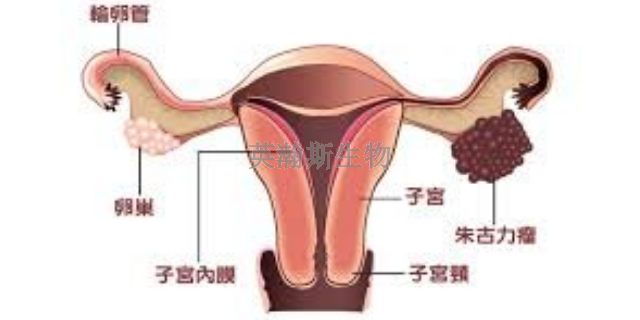 山东比较好的子宫内膜异位症模型有哪家,子宫内膜异位症模型