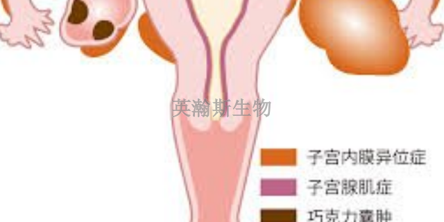 上海推荐的子宫内膜异位症模型怎么造模