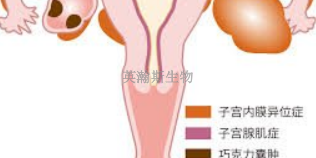 福建專門做子宮內(nèi)膜異位癥模型,子宮內(nèi)膜異位癥模型